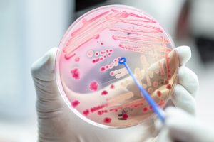 Lire la suite à propos de l’article Les pays africains se mobilisent face à la dangereuse menace de la résistance antimicrobienne